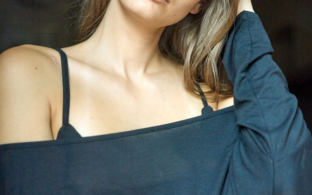 NELA